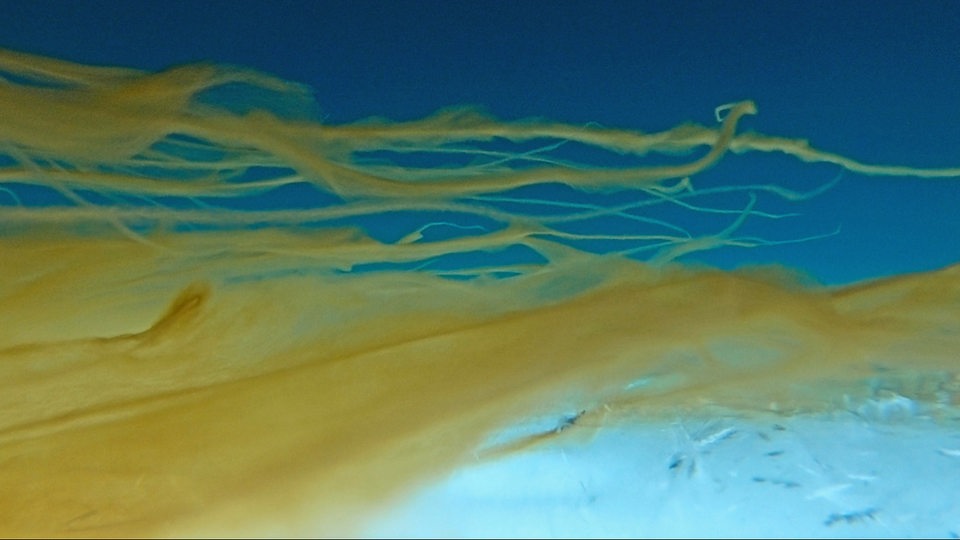 Unterwasseraufnahme der Melosira Algae